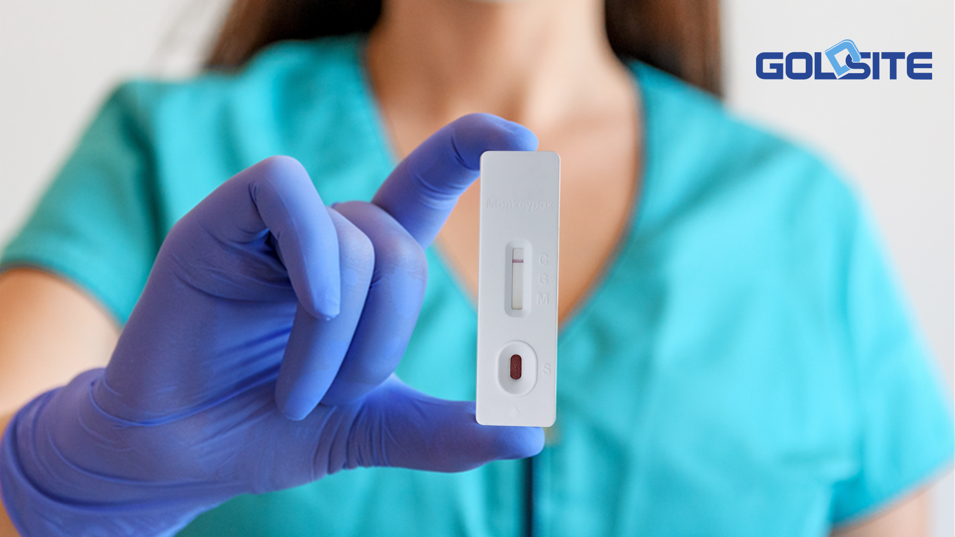 ���ѧߧߧ֧� Monkeypox Ab